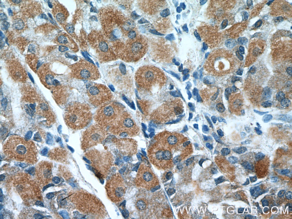 Immunohistochemistry (IHC) staining of human stomach tissue using PPFIBP2 Polyclonal antibody (13953-1-AP)