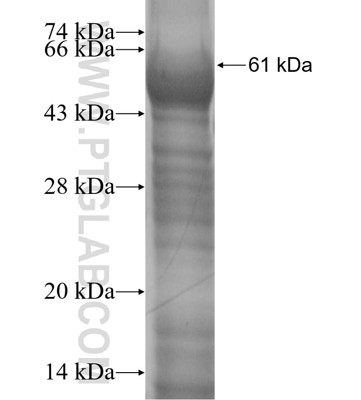 PPFIBP2 fusion protein Ag5064 SDS-PAGE