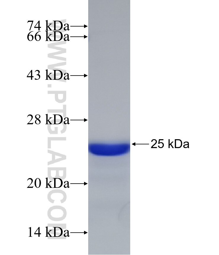 PPHLN1 fusion protein Ag32778 SDS-PAGE