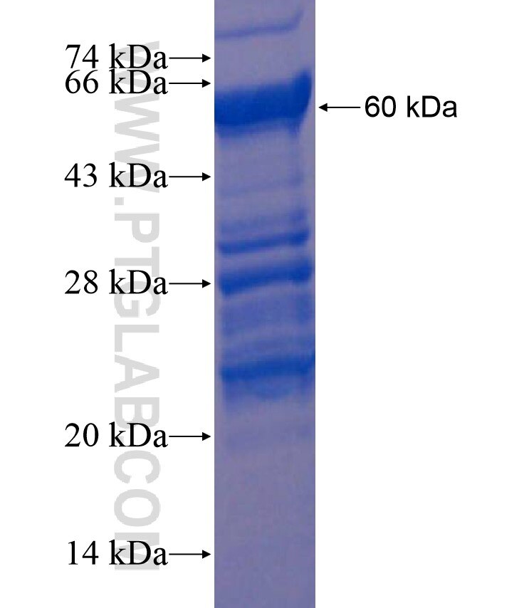 PPHLN1 fusion protein Ag18029 SDS-PAGE