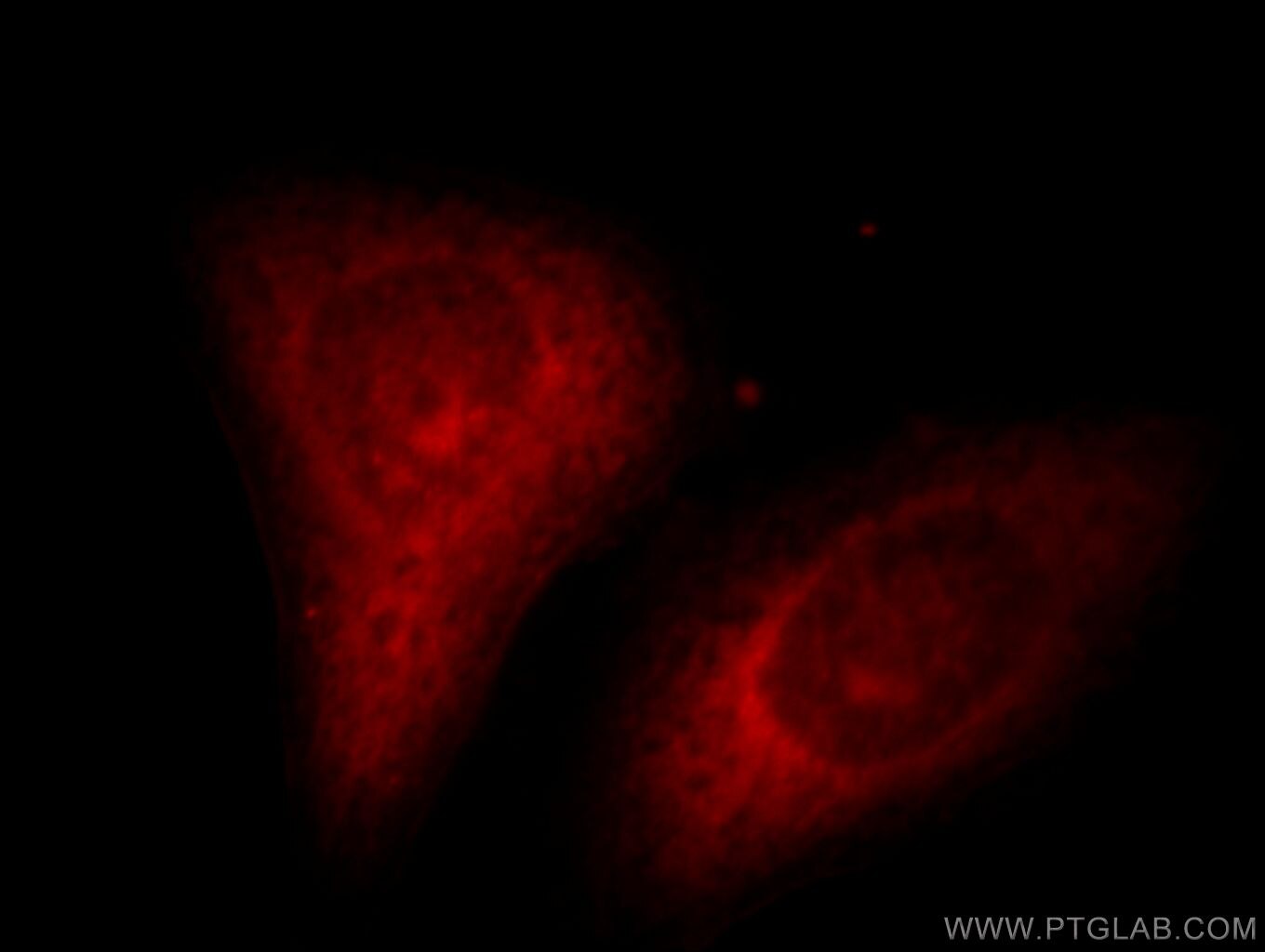 Cyclophilin A