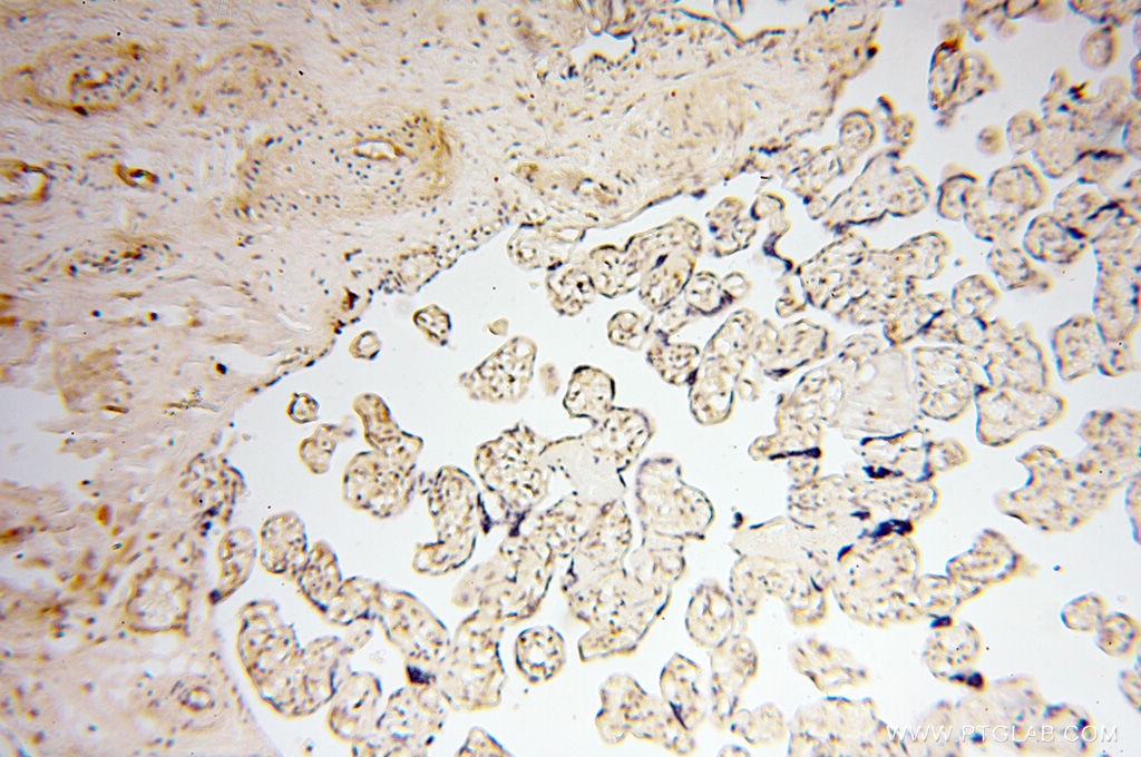 Immunohistochemistry (IHC) staining of human placenta tissue using Cyclophilin A Polyclonal antibody (10720-1-AP)