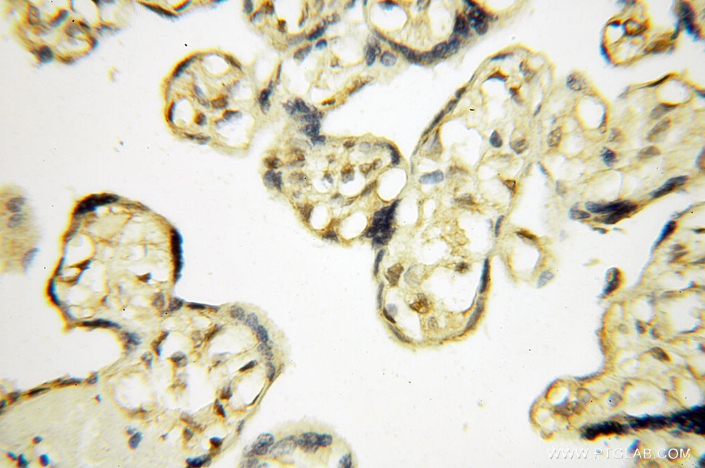 Immunohistochemistry (IHC) staining of human placenta tissue using Cyclophilin A Polyclonal antibody (10720-1-AP)