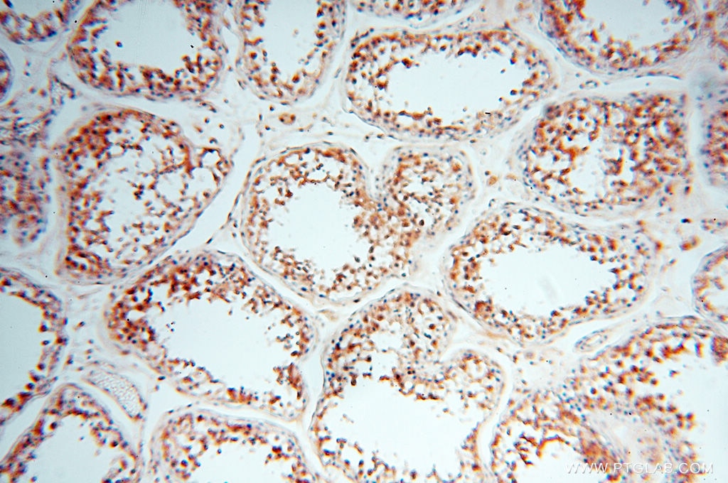 Immunohistochemistry (IHC) staining of human testis tissue using Cyclophilin A Polyclonal antibody (10720-1-AP)