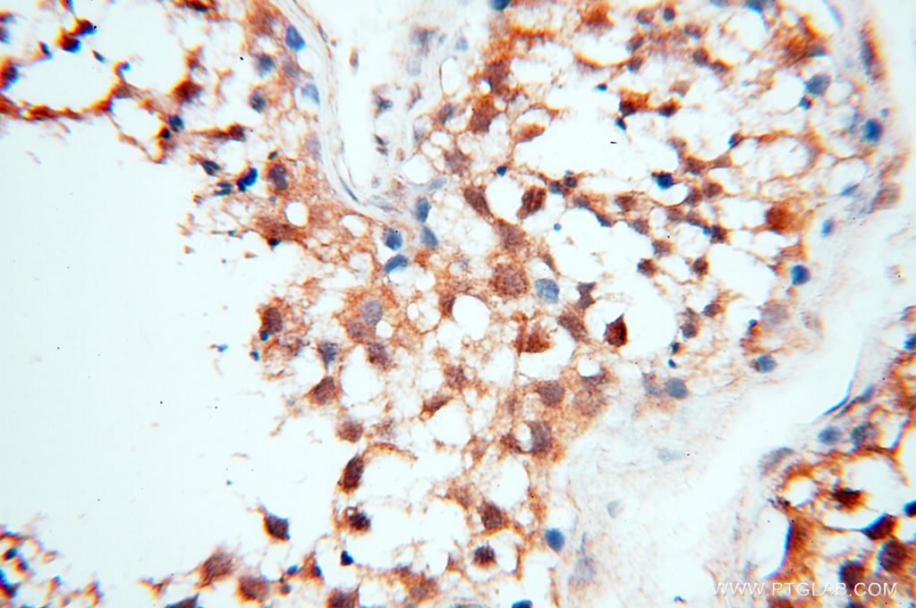 Immunohistochemistry (IHC) staining of human testis tissue using Cyclophilin A Polyclonal antibody (10720-1-AP)