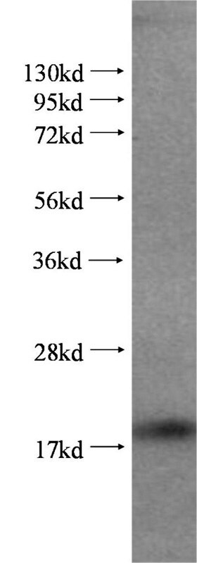 Western Blot (WB) analysis of Jurkat cells using Cyclophilin A Polyclonal antibody (51040-1-AP)