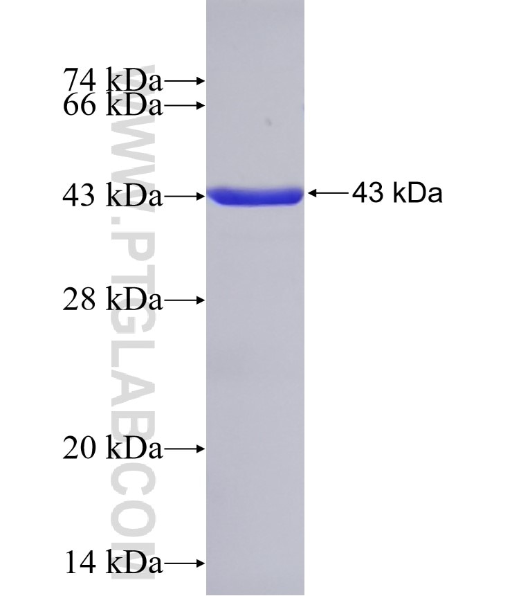 CYPA fusion protein Ag1120 SDS-PAGE