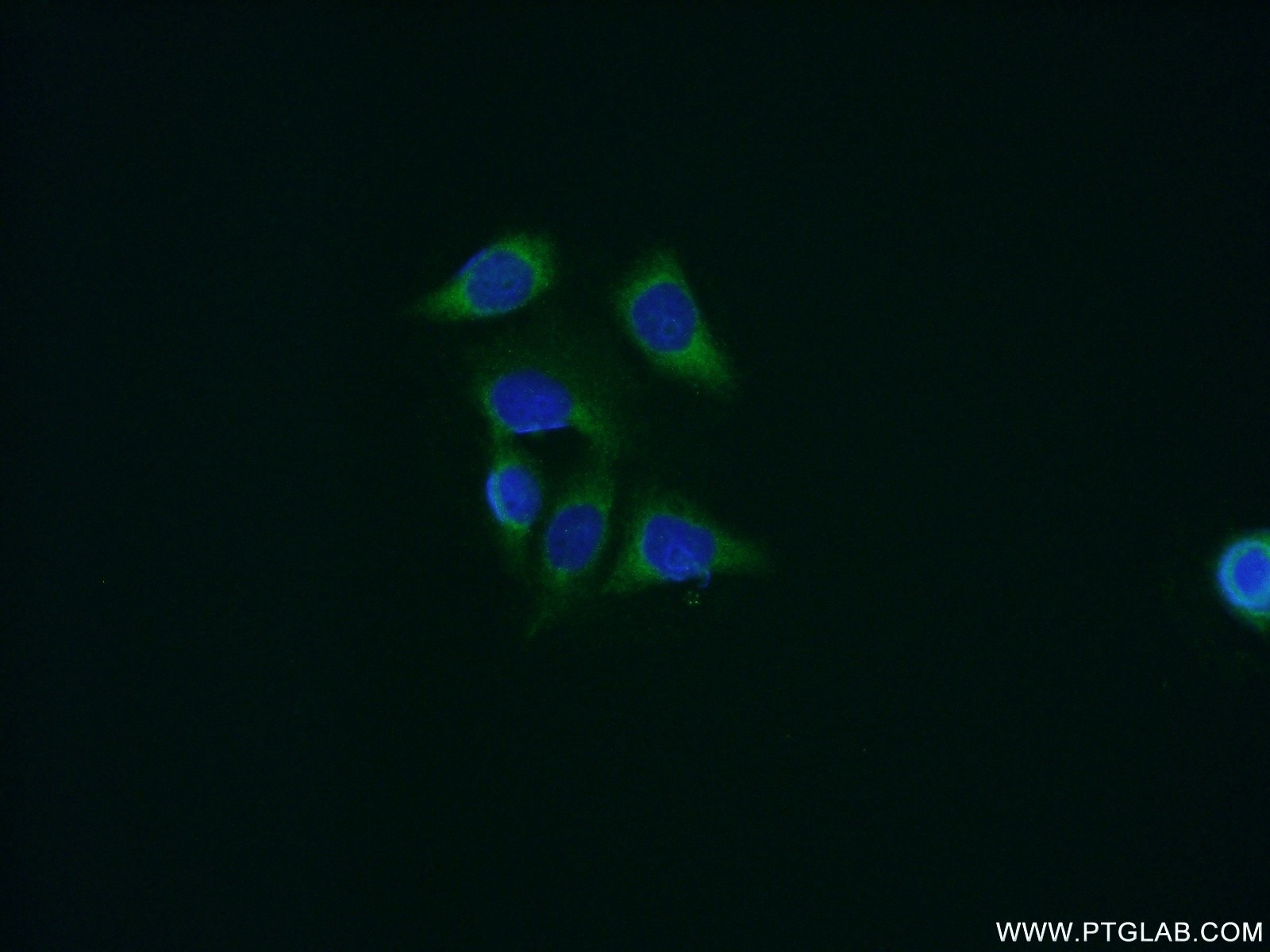 Immunofluorescence (IF) / fluorescent staining of HeLa cells using Cyclophilin B Polyclonal antibody (11607-1-AP)
