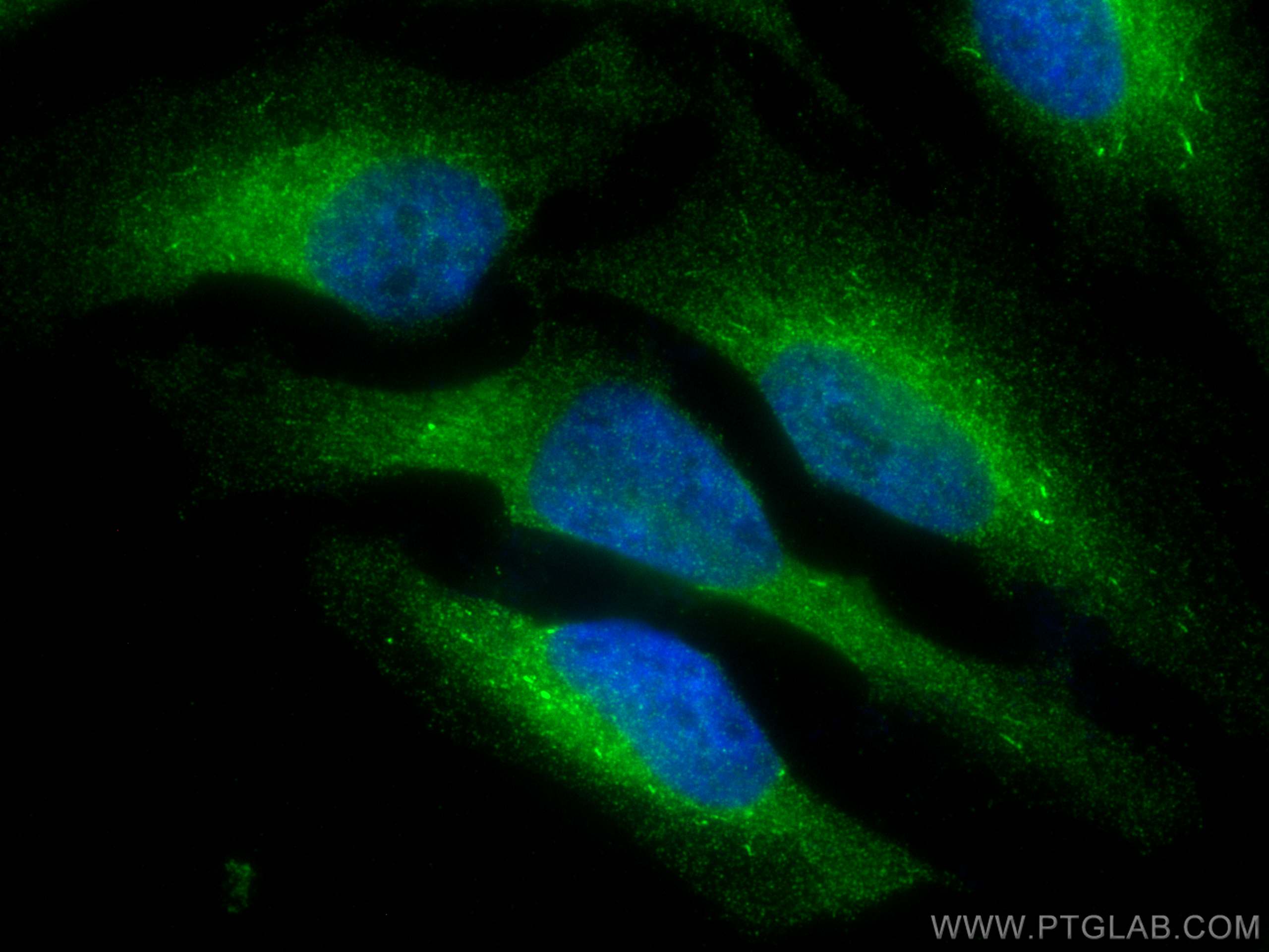 Immunofluorescence (IF) / fluorescent staining of HeLa cells using Cyclophilin B Monoclonal antibody (66047-1-Ig)