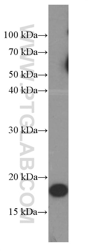 Western Blot (WB) analysis of HEK-293 cells using Cyclophilin B Monoclonal antibody (66047-1-Ig)