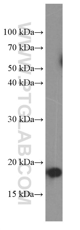 Western Blot (WB) analysis of Jurkat cells using Cyclophilin B Monoclonal antibody (66047-1-Ig)