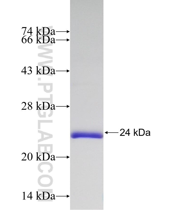 PPIB fusion protein Ag17957 SDS-PAGE