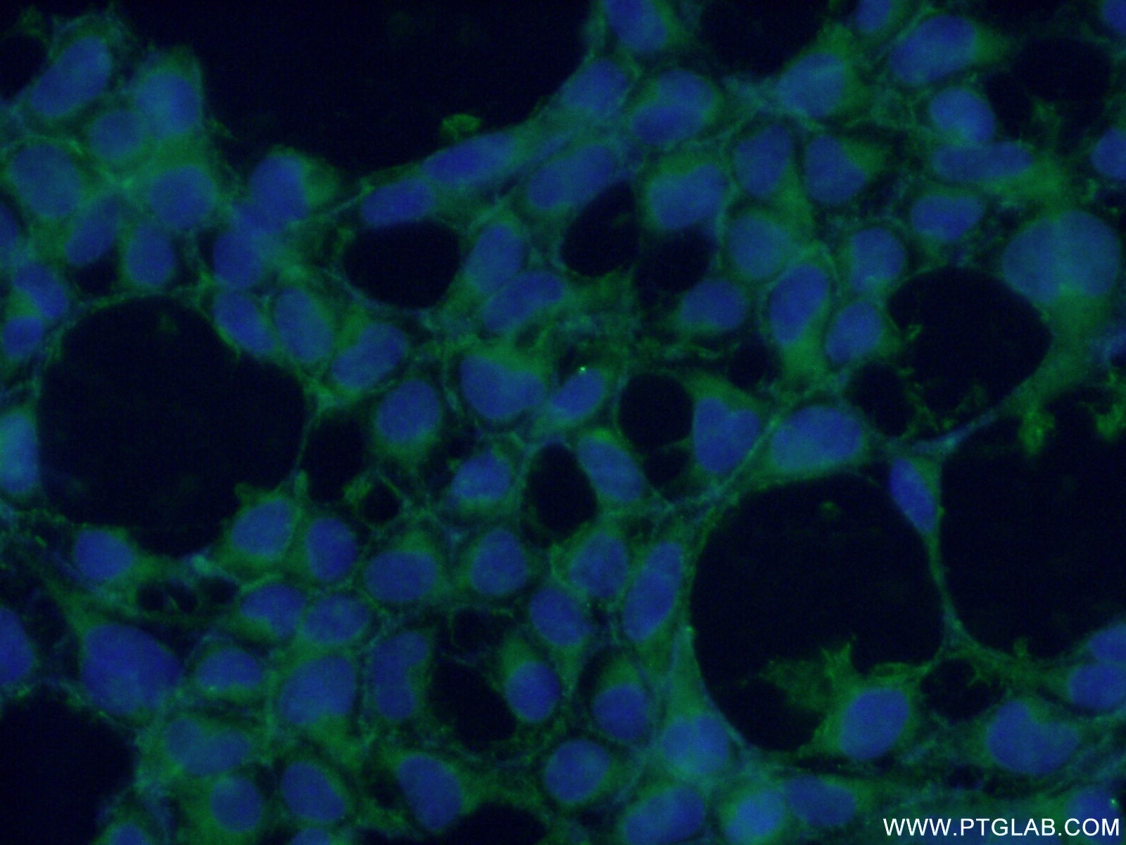 Immunofluorescence (IF) / fluorescent staining of HEK-293 cells using CYPC Polyclonal antibody (10287-2-AP)