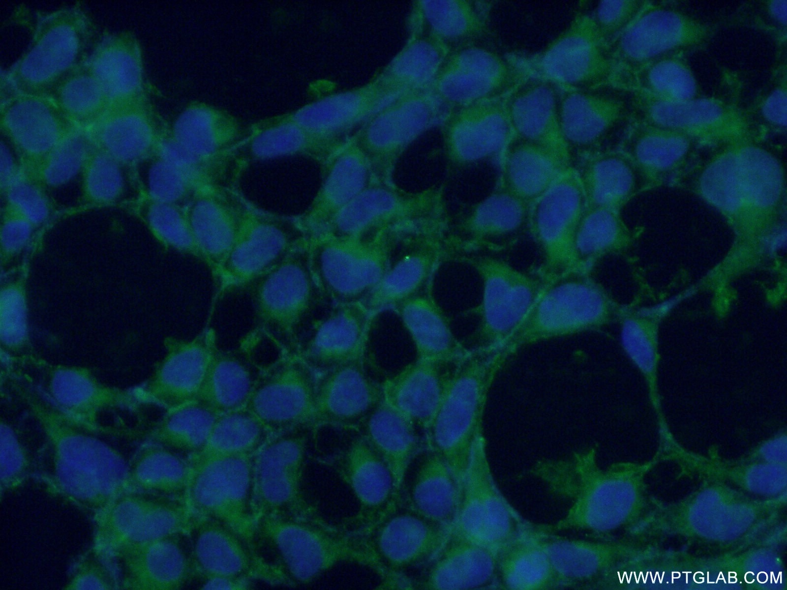 Immunofluorescence (IF) / fluorescent staining of HEK-293 cells using CYPC Polyclonal antibody (10287-2-AP)