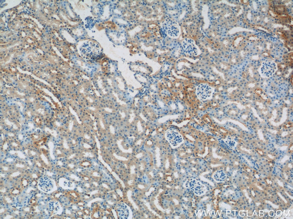 Immunohistochemistry (IHC) staining of mouse kidney tissue using CYPC Polyclonal antibody (10287-2-AP)