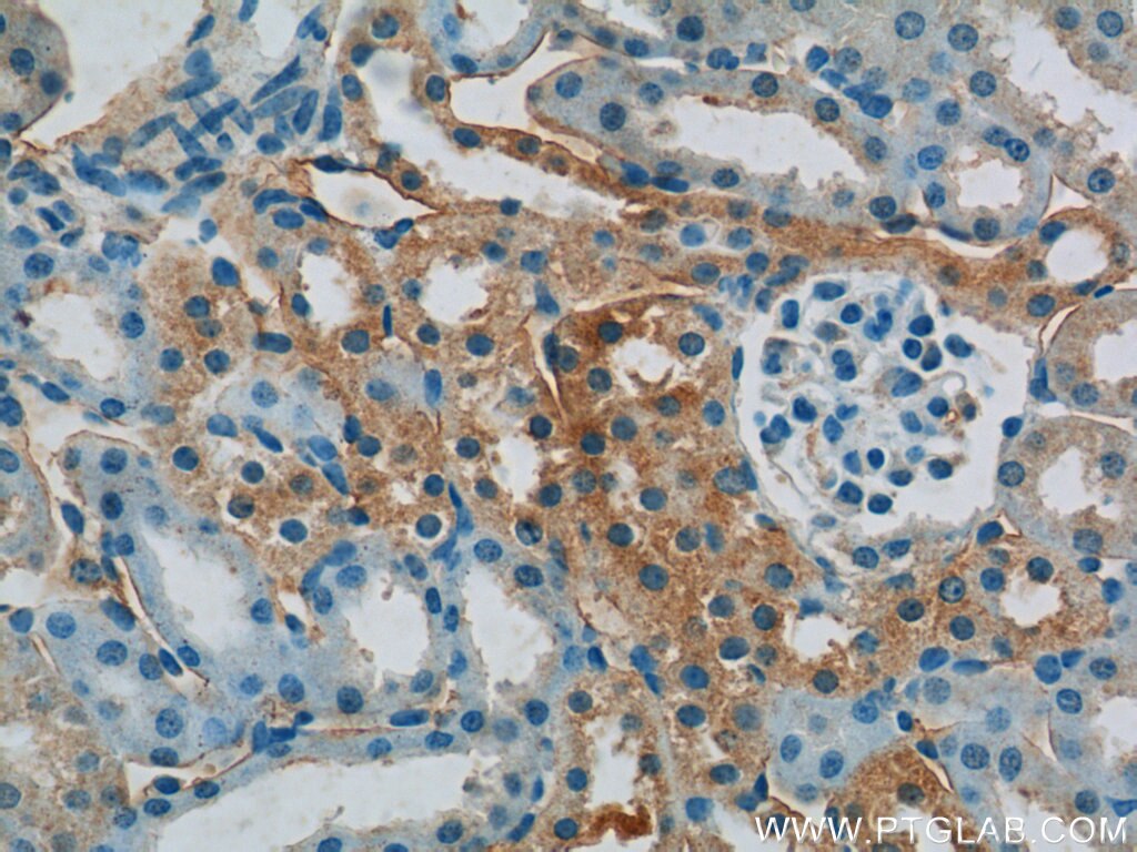 IHC staining of mouse kidney using 10287-2-AP