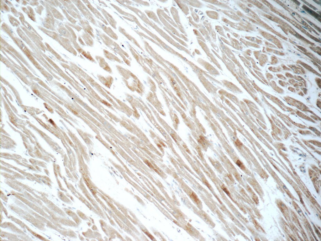 Immunohistochemistry (IHC) staining of human heart tissue using CYPC Polyclonal antibody (10287-2-AP)