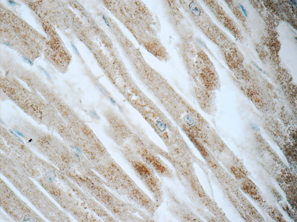 Immunohistochemistry (IHC) staining of human heart tissue using CYPC Polyclonal antibody (10287-2-AP)