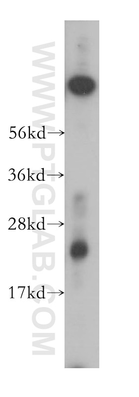 Western Blot (WB) analysis of mouse heart tissue using CYPC Polyclonal antibody (10287-2-AP)