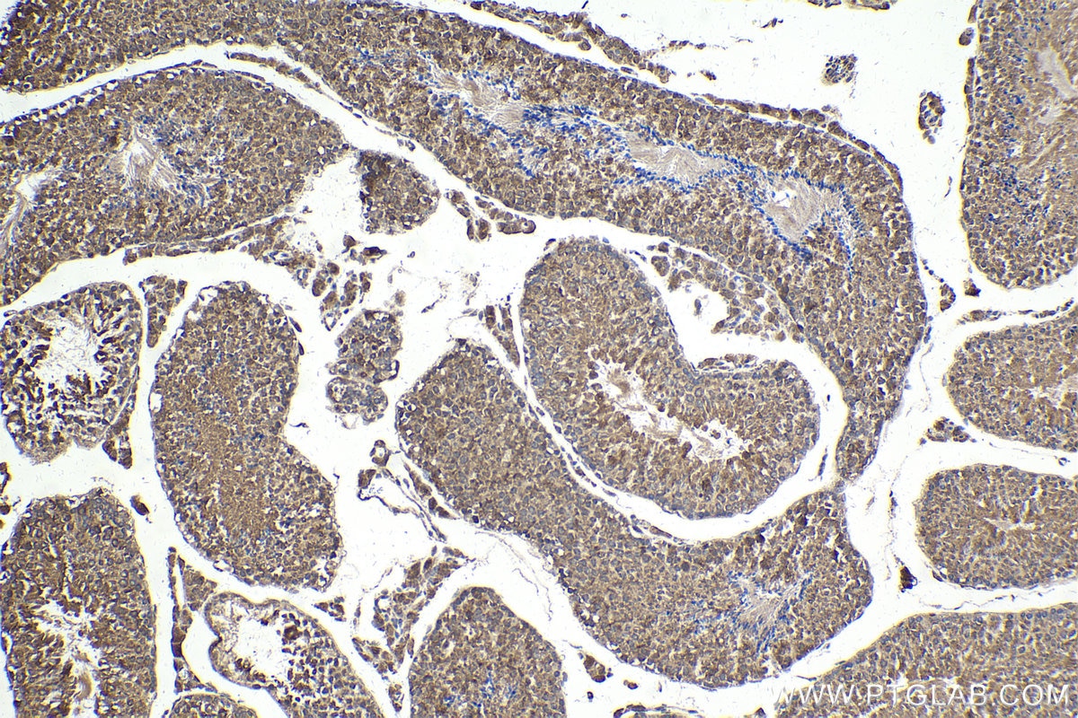 Immunohistochemistry (IHC) staining of mouse testis tissue using PPID Polyclonal antibody (12716-1-AP)