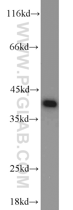 Western Blot (WB) analysis of human brain tissue using PPID Polyclonal antibody (12716-1-AP)