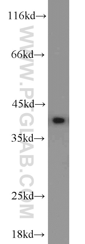 Western Blot (WB) analysis of human brain tissue using PPID Polyclonal antibody (12716-1-AP)