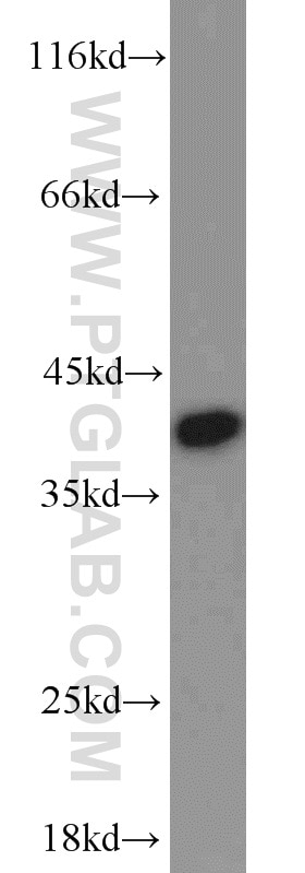 Western Blot (WB) analysis of human brain tissue using PPID Polyclonal antibody (12716-1-AP)