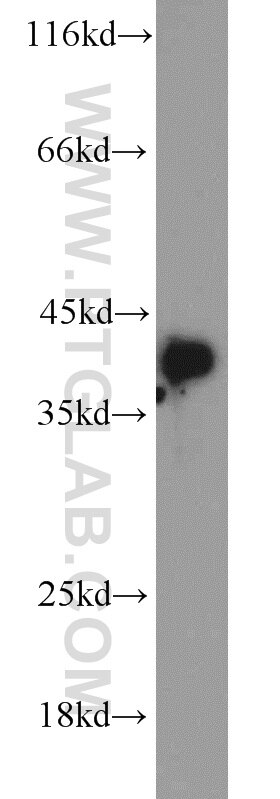 Western Blot (WB) analysis of A549 cells using PPID Polyclonal antibody (12716-1-AP)