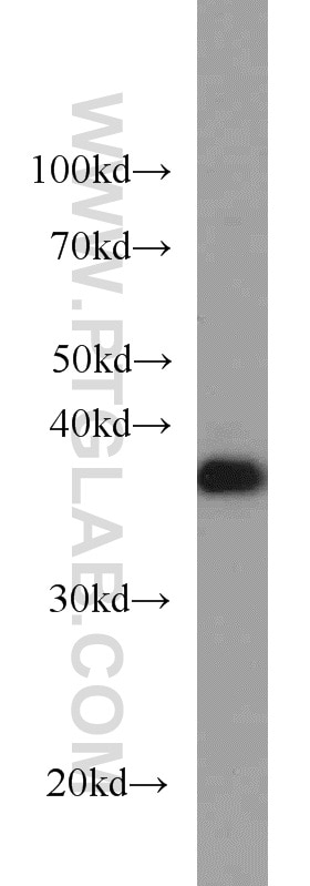 WB analysis of MCF-7 using 12716-1-AP