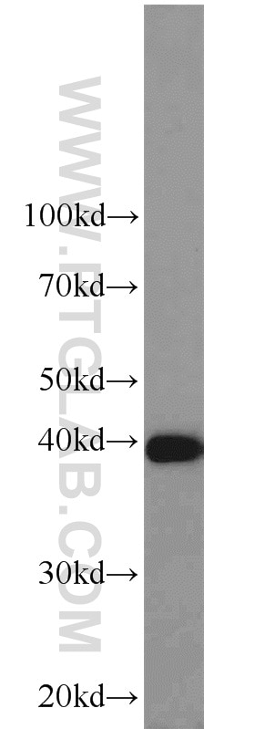 Western Blot (WB) analysis of human brain tissue using PPID Polyclonal antibody (12716-1-AP)