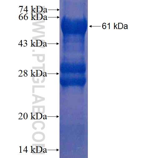 PPID fusion protein Ag3409 SDS-PAGE