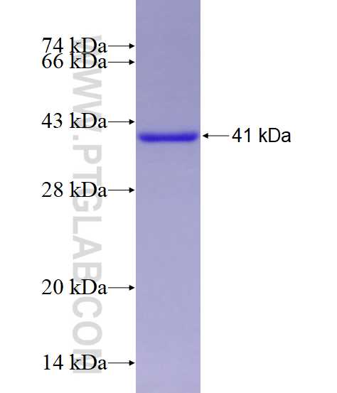 PPID fusion protein Ag4371 SDS-PAGE