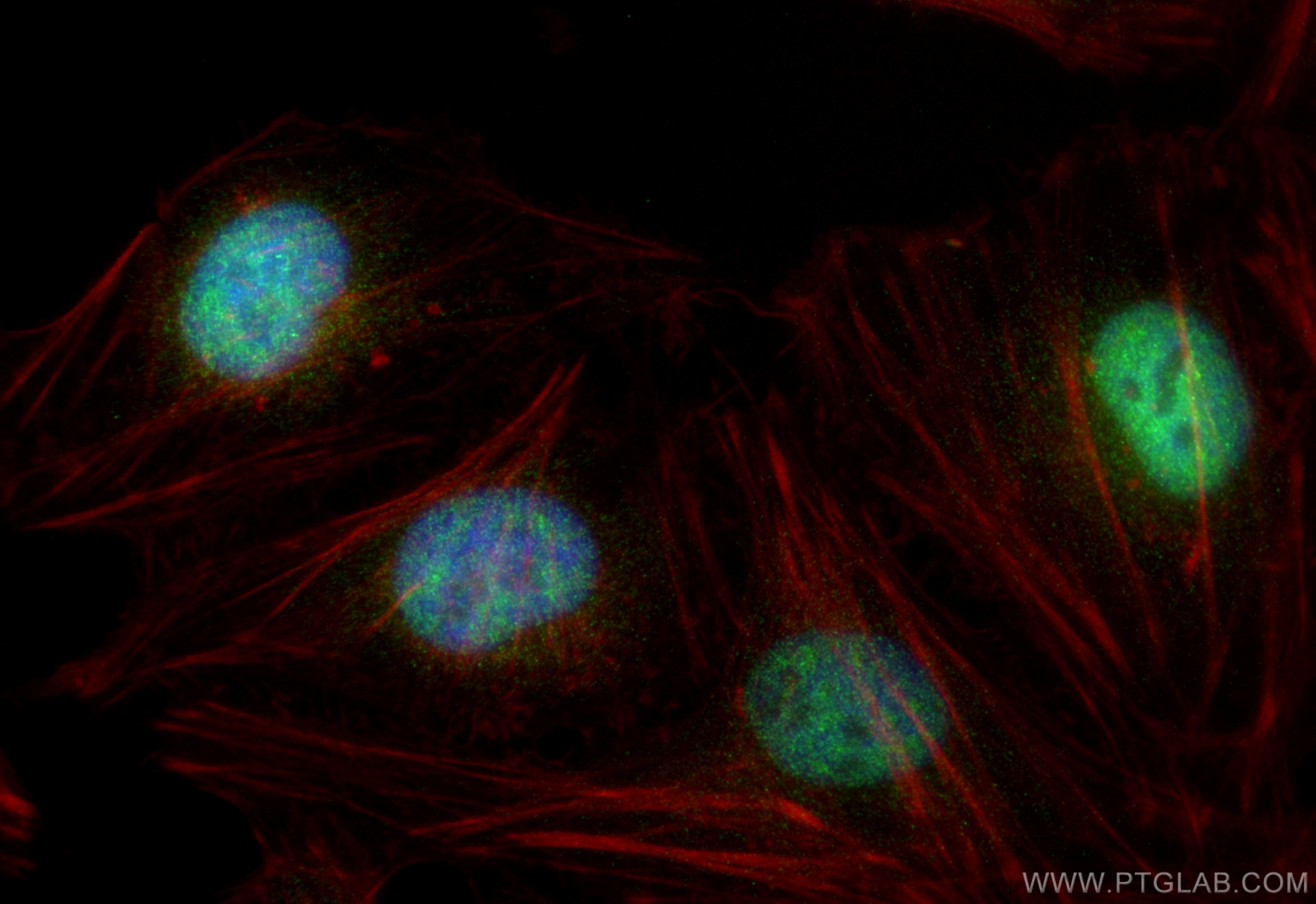 Immunofluorescence (IF) / fluorescent staining of HeLa cells using Cyclophilin E Polyclonal antibody (15357-1-AP)