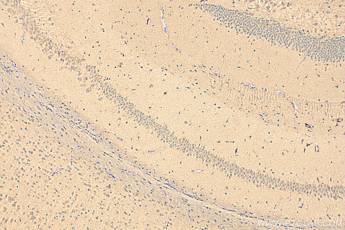 Immunohistochemistry (IHC) staining of mouse brain tissue using Cyclophilin E Polyclonal antibody (15357-1-AP)