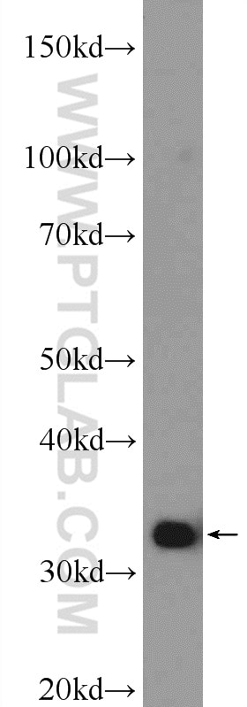 WB analysis of HeLa using 15357-1-AP