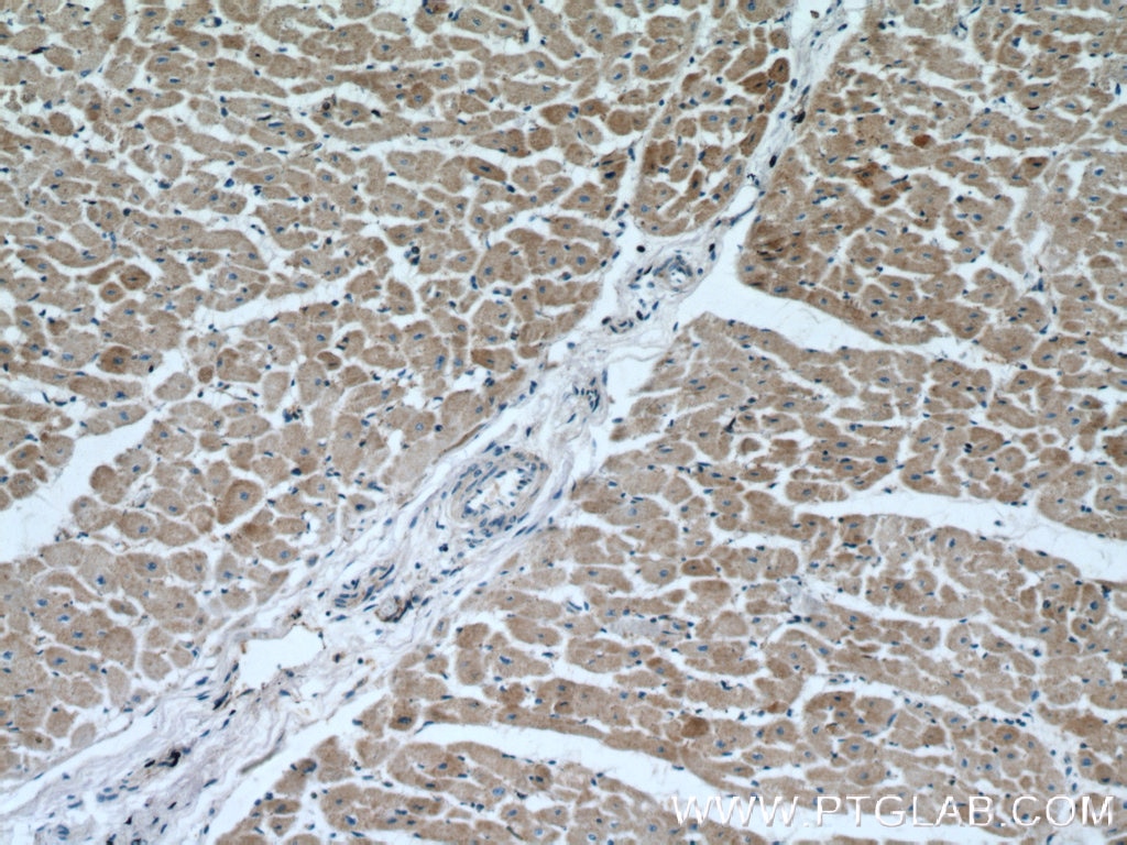 Immunohistochemistry (IHC) staining of human heart tissue using PPIF-Specific Polyclonal antibody (18466-1-AP)