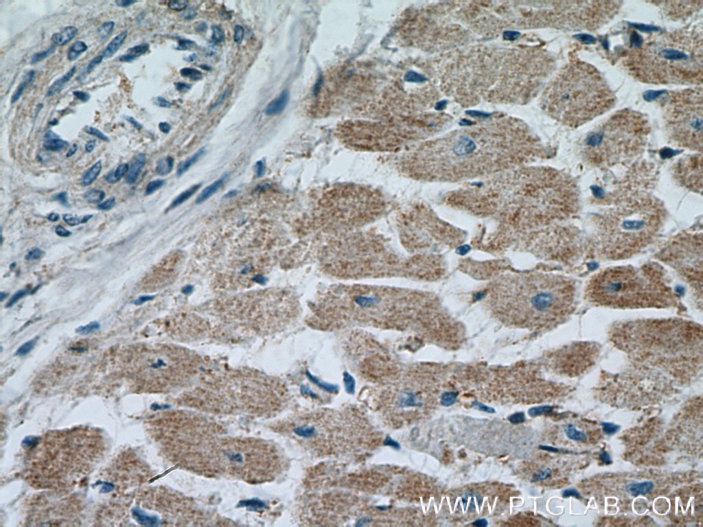 Immunohistochemistry (IHC) staining of human heart tissue using PPIF-Specific Polyclonal antibody (18466-1-AP)