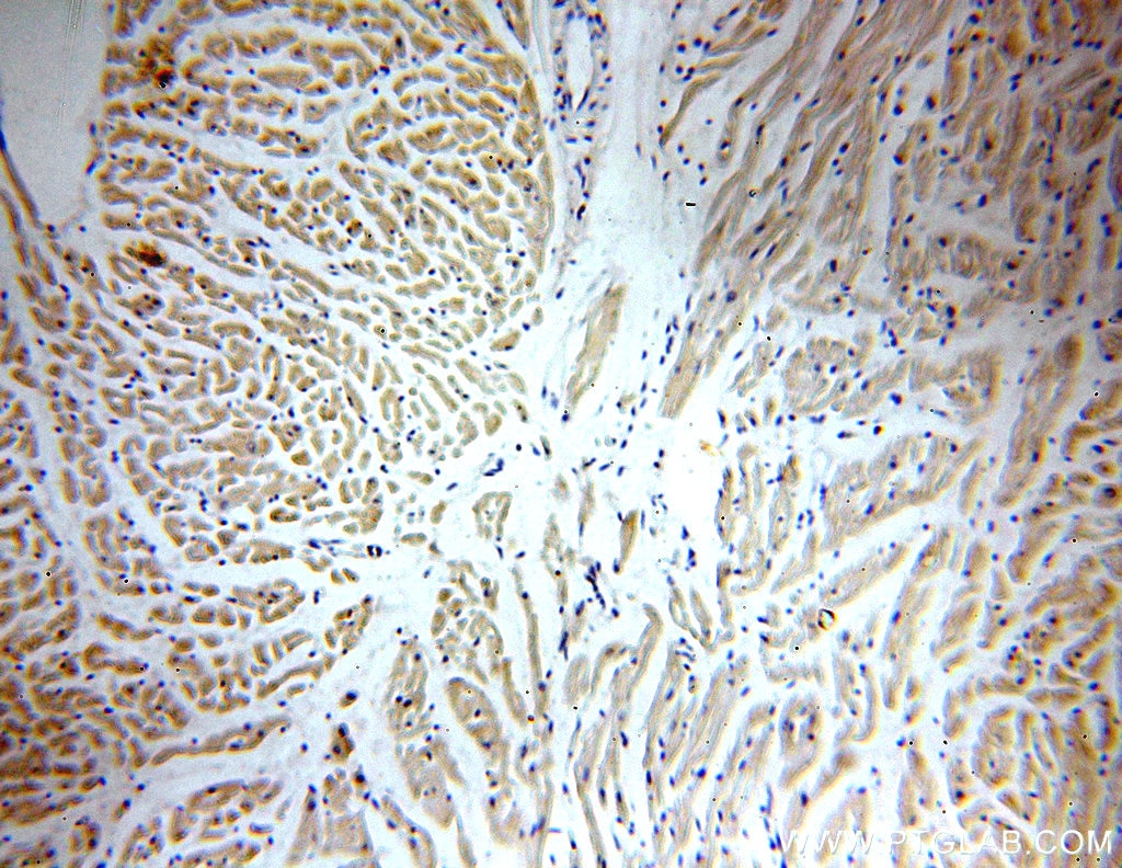 Immunohistochemistry (IHC) staining of human heart tissue using PPIF-Specific Polyclonal antibody (18466-1-AP)