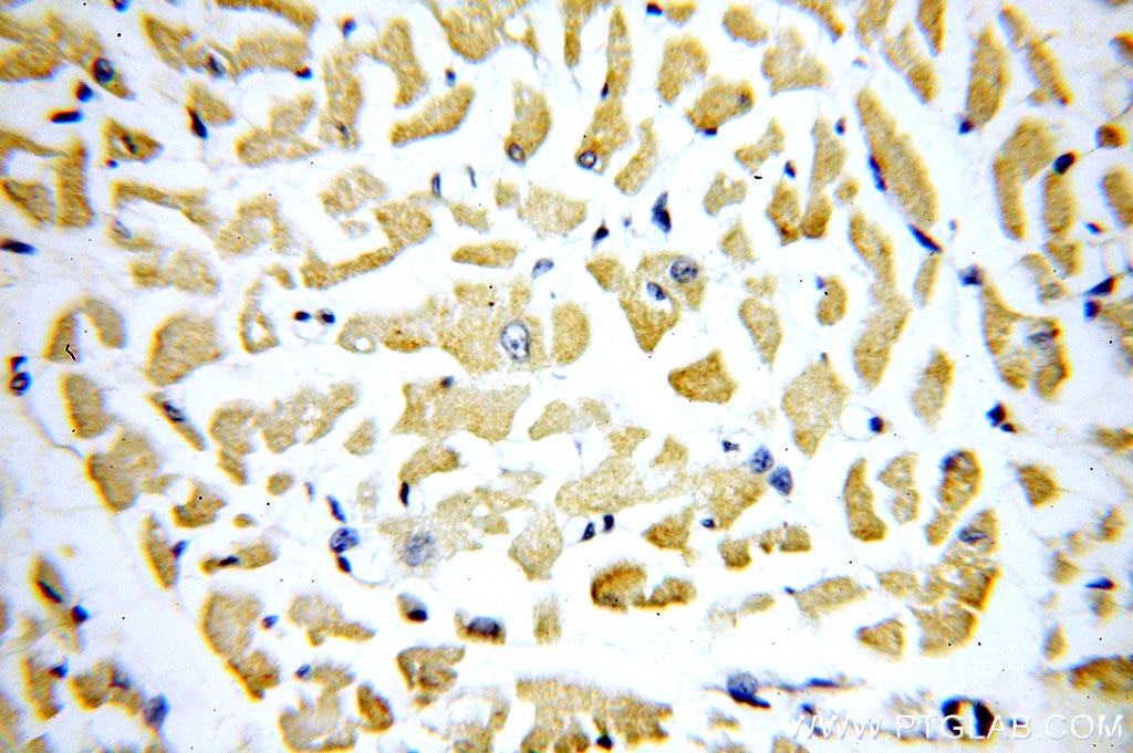 Immunohistochemistry (IHC) staining of human heart tissue using PPIF-Specific Polyclonal antibody (18466-1-AP)