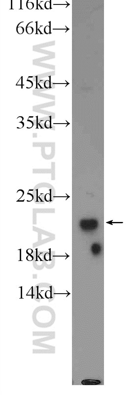 Western Blot (WB) analysis of rat heart tissue using PPIF-Specific Polyclonal antibody (18466-1-AP)