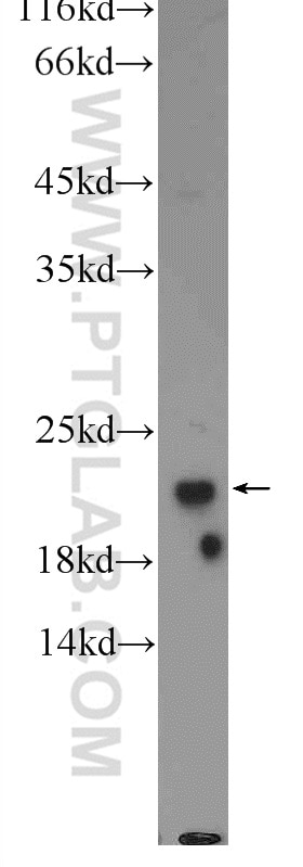 WB analysis of rat heart using 18466-1-AP