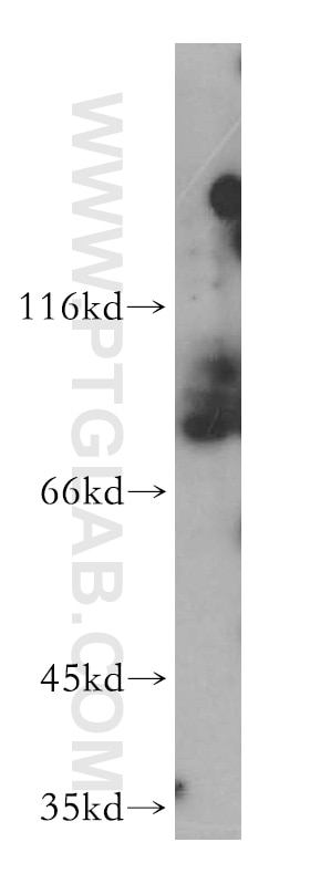 Western Blot (WB) analysis of Jurkat cells using PPIG Polyclonal antibody (12985-1-AP)