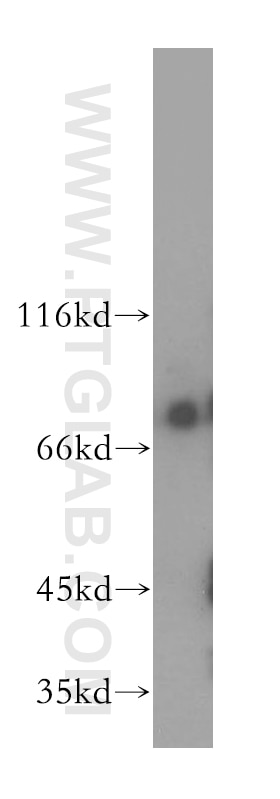 Western Blot (WB) analysis of human liver tissue using PPIG Polyclonal antibody (12985-1-AP)