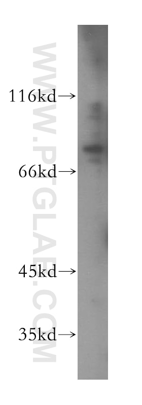 Western Blot (WB) analysis of SH-SY5Y cells using PPIG Polyclonal antibody (12985-1-AP)