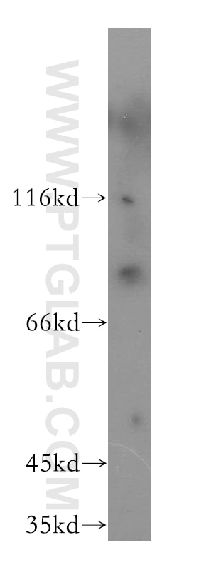 Western Blot (WB) analysis of NIH/3T3 cells using PPIG Polyclonal antibody (12985-1-AP)