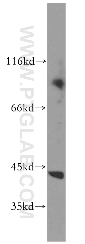 Western Blot (WB) analysis of Jurkat cells using PPIG Polyclonal antibody (12985-1-AP)