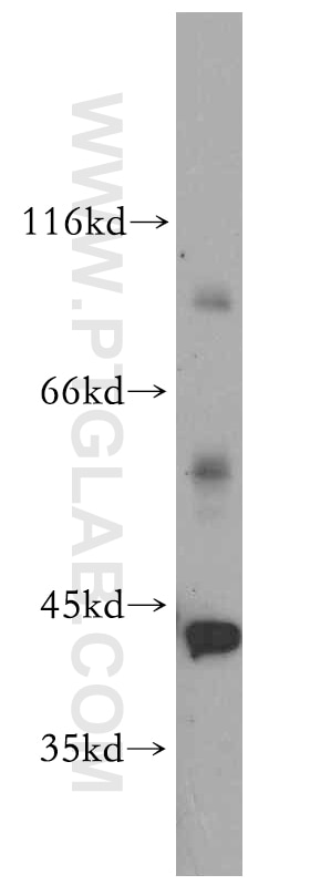 WB analysis of SH-SY5Y using 12985-1-AP