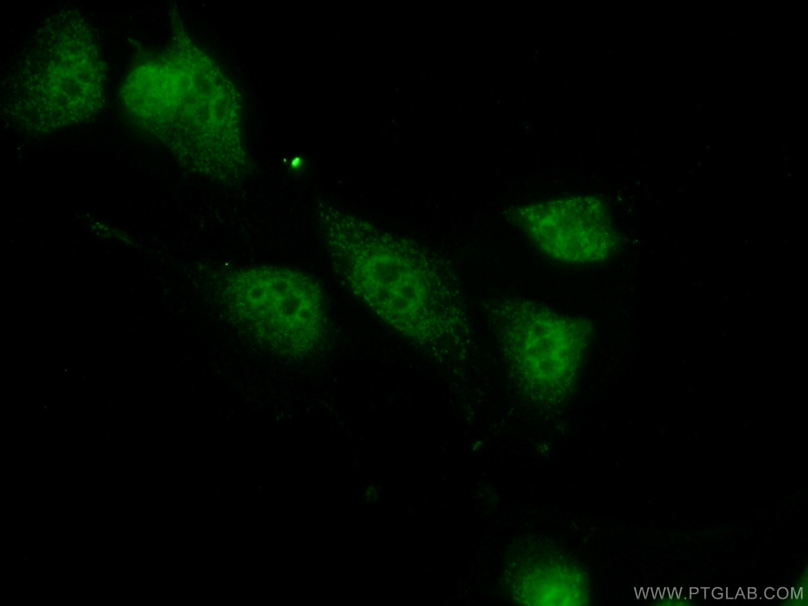 IF Staining of NIH/3T3 using 15144-1-AP