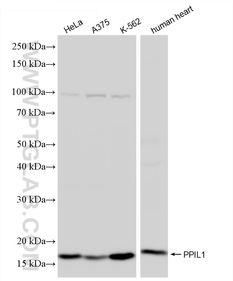Western Blot (WB) analysis of various lysates using PPIL1 Recombinant antibody (86312-1-RR)