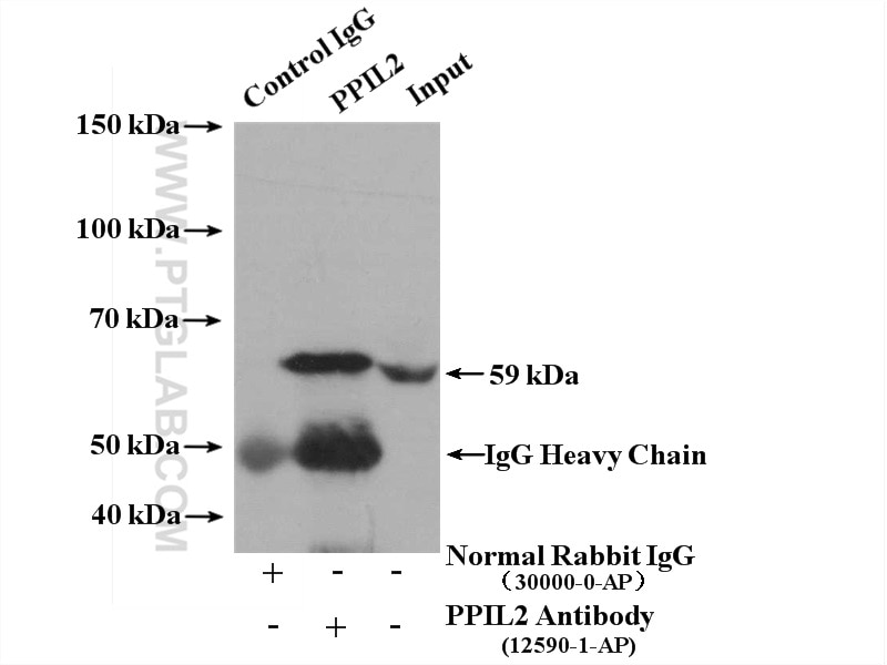 Immunoprecipitation (IP) experiment of HEK-293 cells using PPIL2 Polyclonal antibody (12590-2-AP)